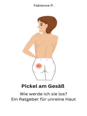 cover image of Pickel am Gesäß